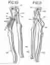 Fig. 06 - Quick adjusting pliers