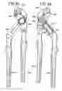 Fig. 10 - Quick adjusting pliers