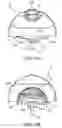 Fig. 26 - Nebulizing drug delivery device with barrier