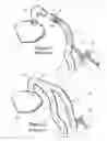Fig. 02 - SCENTED ANESTHESIA BREATHING CIRCUIT