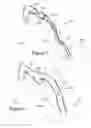 Fig. 03 - SCENTED ANESTHESIA BREATHING CIRCUIT