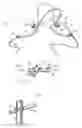 Fig. 02 - Ocular surgical protective shield