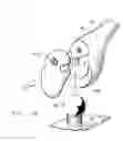 Fig. 11 - Ocular surgical protective shield
