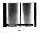 Fig. 05 - Rigid comb having microtexturized-tip teeth for hair cleaning