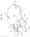 Fig. 07 - Apparatus and method for attaching fencing material