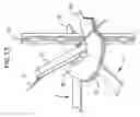 Fig. 14 - Apparatus and method for attaching fencing material