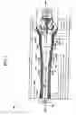 Fig. 03 - Submerged entry nozzle with installable parts