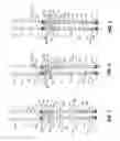 Fig. 02 - Washpipeless frac pack system