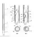 Fig. 02 - Method of deploying and powering an electrically driven in a well