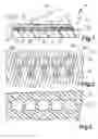 Fig. 02 - Operating control comprising a capacitive sensor element and an electrical device comprising an operating control of this type