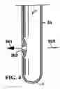Fig. 04 - Conductor pipe string deflector and method