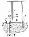 Fig. 10 - Conductor pipe string deflector and method
