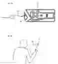 Fig. 19 - Biosensor
