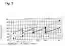 Fig. 03 - Method for power regulation of a defroster heater and refrigeration device with integrated defroster heating