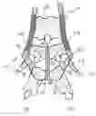 Fig. 01 - SUBMERGED ENTRY NOZZLE