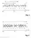 Fig. 04 - Method and device for controlling a crusher, and a pointer instrument for indication of load on a crusher