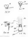 Fig. 06 - Barkersville scooper device