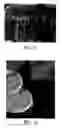 Fig. 07 - High heat dissipating LED having a porous material layer