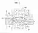Fig. 04 - Chip holder and chip treatmant method