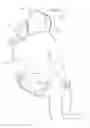 Fig. 03 - Lateral head restraint system