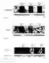 Fig. 05 - Material condition assessment with eddy current sensors