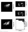 Fig. 05 - Motion compensation for magnetic resonance imaging