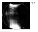 Fig. 10 - Sense optimized MRI RF coil designed with a target field method