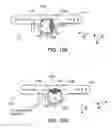 Fig. 08 - Reducing effect of magnetic and electromagnetic fields on an implant's magnet and/or electronics