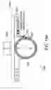 Fig. 11 - Reducing effect of magnetic and electromagnetic fields on an implant's magnet and/or electronics
