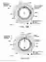 Fig. 12 - Reducing effect of magnetic and electromagnetic fields on an implant's magnet and/or electronics