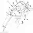 Fig. 04 - Ophthalmoscope