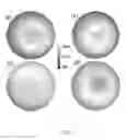 Fig. 12 - Imaging of macular pigment distributions