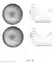 Fig. 16 - Imaging of macular pigment distributions