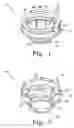 Fig. 02 - Lens systems for vitreoretinal surgery