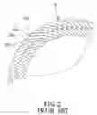 Fig. 03 - Optical projecting system