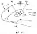 Fig. 14 - Using a leaf spring to attach clamp plates with a heat sink to both sides of a component mounted on a printed circuit assembly