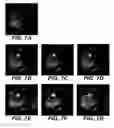 Fig. 08 - Methods and systems for automated detection and analysis of lesion on magnetic resonance images