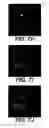 Fig. 09 - Methods and systems for automated detection and analysis of lesion on magnetic resonance images