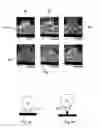 Fig. 04 - Powder injection system and method