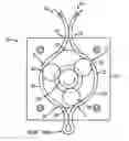 Fig. 01 - Pulseless peristaltic pump