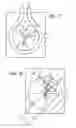 Fig. 08 - Pulseless peristaltic pump