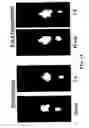 Fig. 16 - Poly(peptide) as a chelator: methods of manufacture and uses