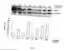 Fig. 02 - Methods for improving cell therapy and tissue regeneration in patients with cardiovascular and neurological diseases by means of shockwaves