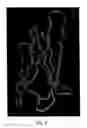 Fig. 04 - Pharmaceutically acceptable FN3 polypeptides for human treatments