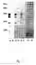 Fig. 02 - Protective antigen of group a streptococci