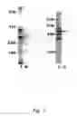 Fig. 04 - Protective antigen of group a streptococci