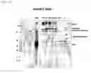 Fig. 19 - Vaccine against hcv