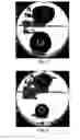 Fig. 02 - Infection resistant medical implants