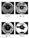 Fig. 07 - Infection resistant medical implants