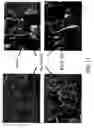 Fig. 35 - Dry particle packaging systems and methods of making same